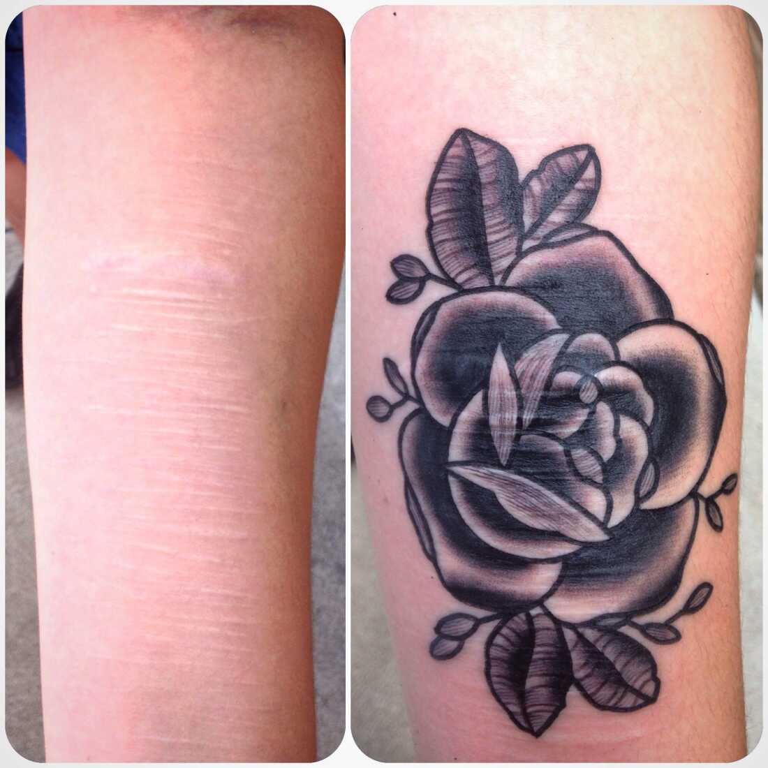 Maddie Keating displays her arm before and after receiving a scar-covering tattoo by Brian Finn.